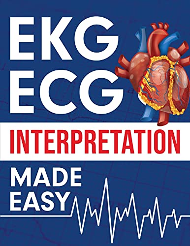 EKG ECG Interpretation Made Easy (Paperback)